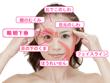 目の美容鍼で、眼瞼下垂、目の下のクマ、ほうれいせん、瞼の浮腫み、おでこのしわ、目元のしわ、ワイスラインの悩みを解消