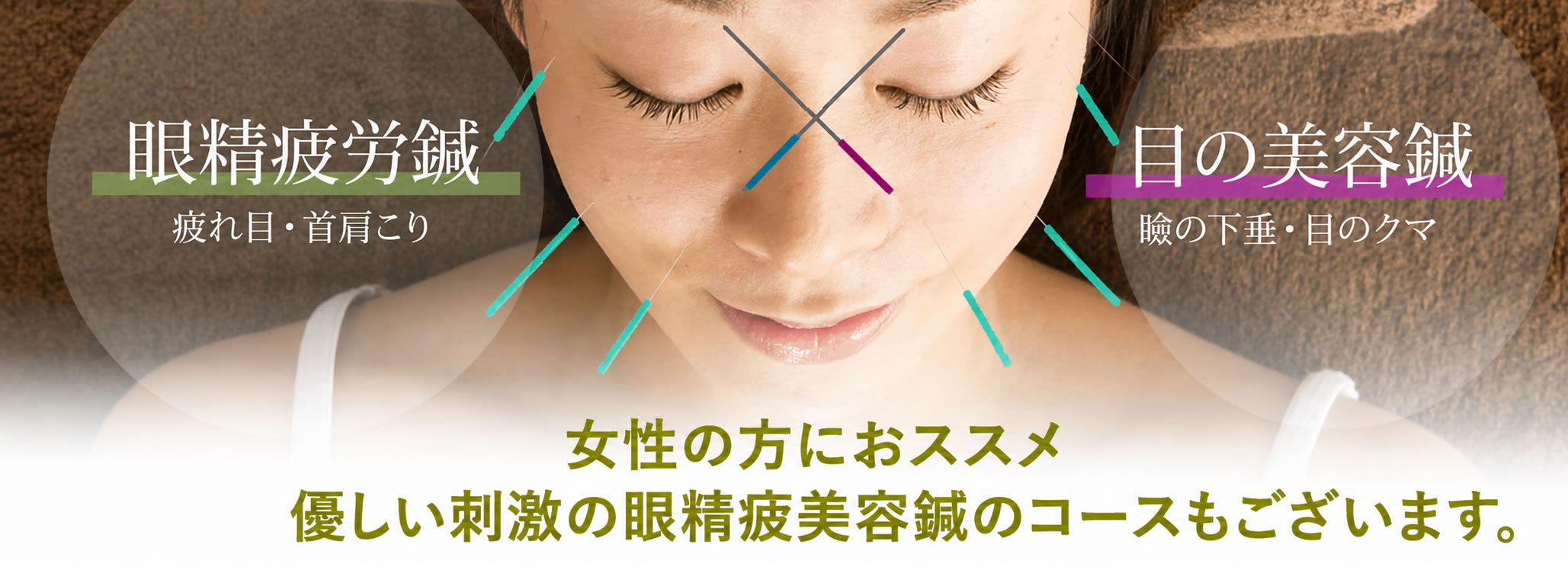 眼精疲労美容鍼コースも大人気