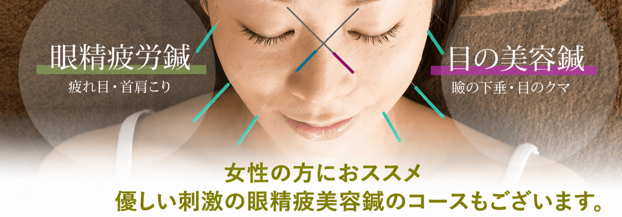 眼精疲労美容鍼コースも大人気